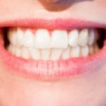 Ładne nienaganne zęby dodatkowo niesamowity uroczy uśmieszek to powód do płenego uśmiechu.